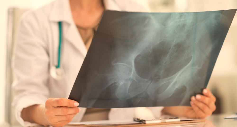 X-ray of abdomen.jpg